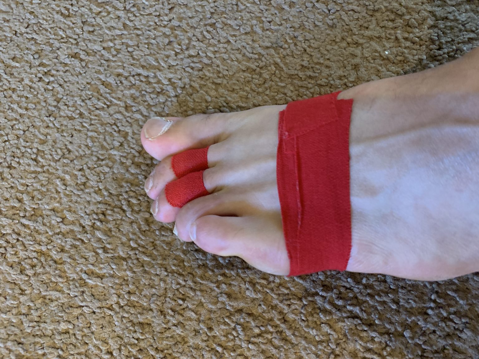 how-to-tape-toes-for-plantar-plate-tear-plantar-health