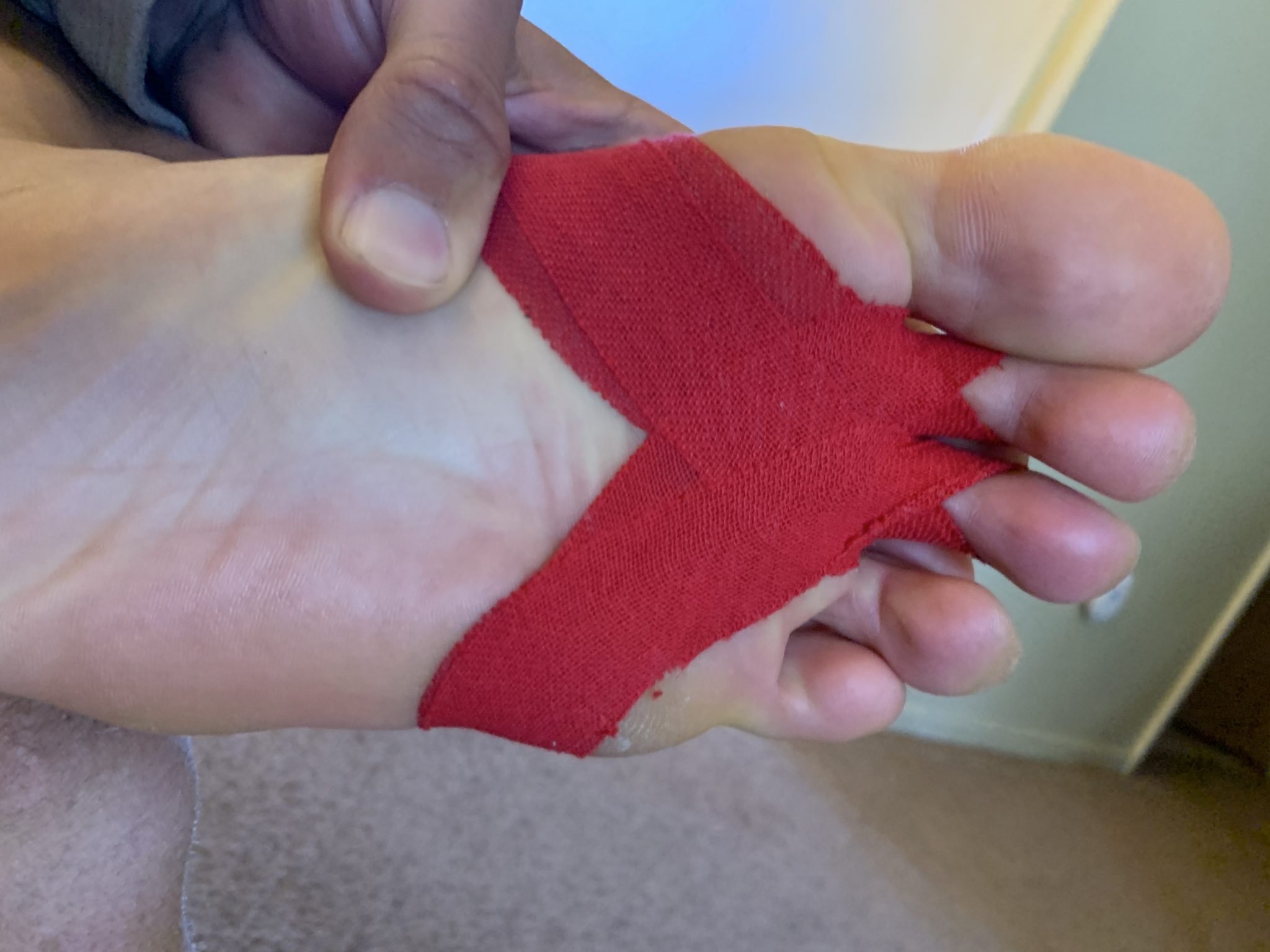 How To Tape Toes for Plantar Plate Tear Plantar Health